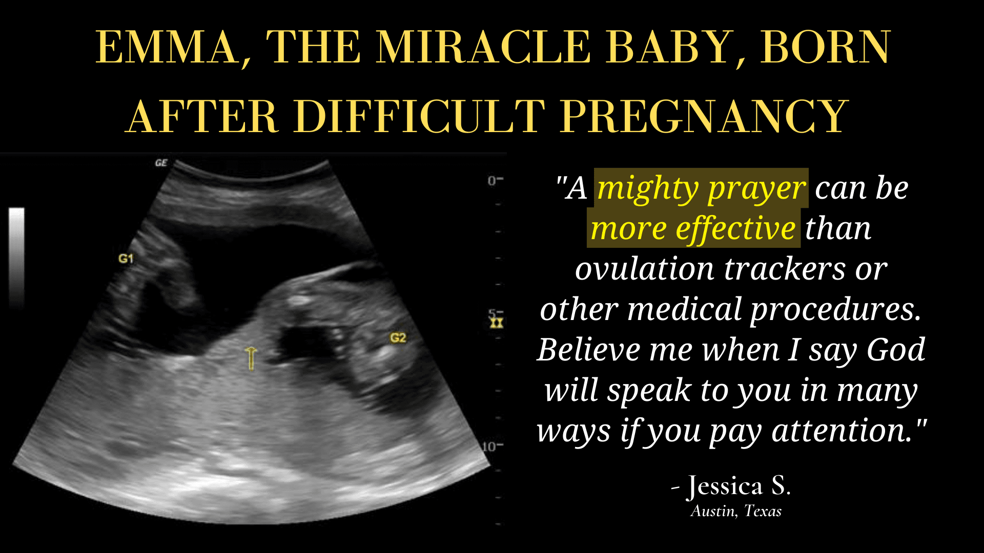 EMMA, THE MIRACLE BABY, BORN AFTER DIFFICULT PREGNANCY | HOLY LAND MAN EXPLAINS